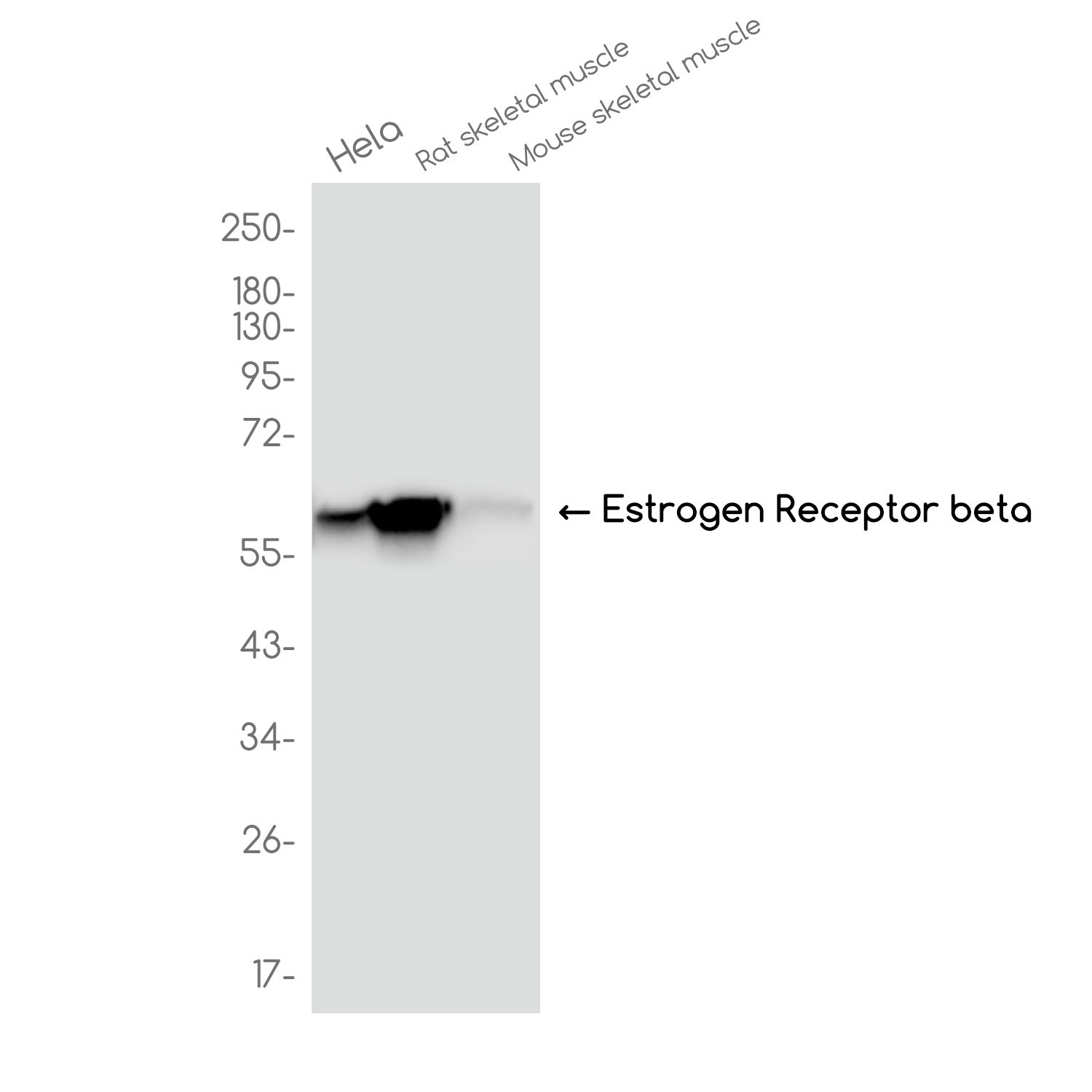 ESR2 Antibody