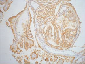 LGALS3 Antibody
