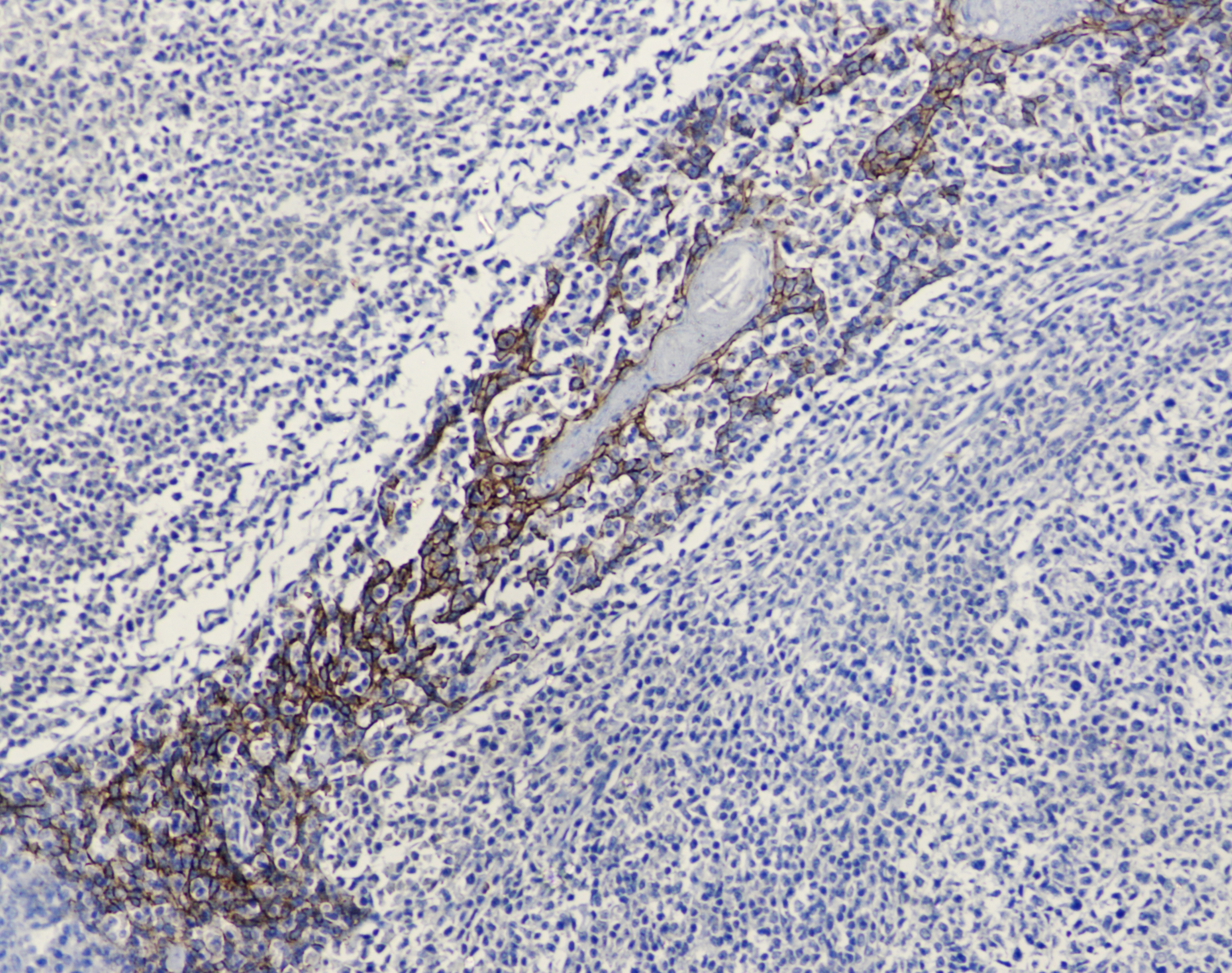 CDH1 Antibody