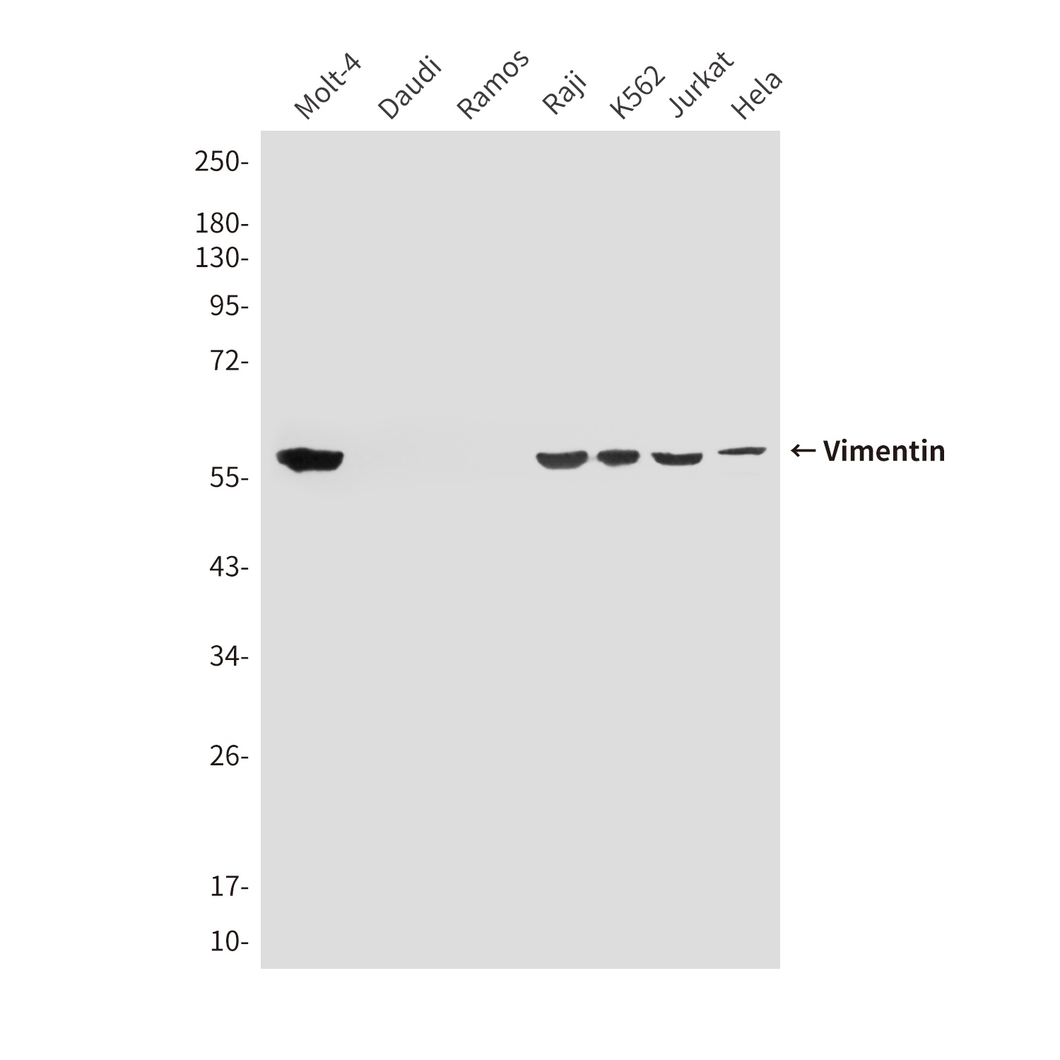 VIM Antibody
