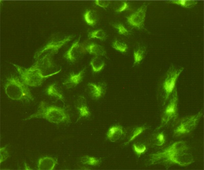 VIM Antibody