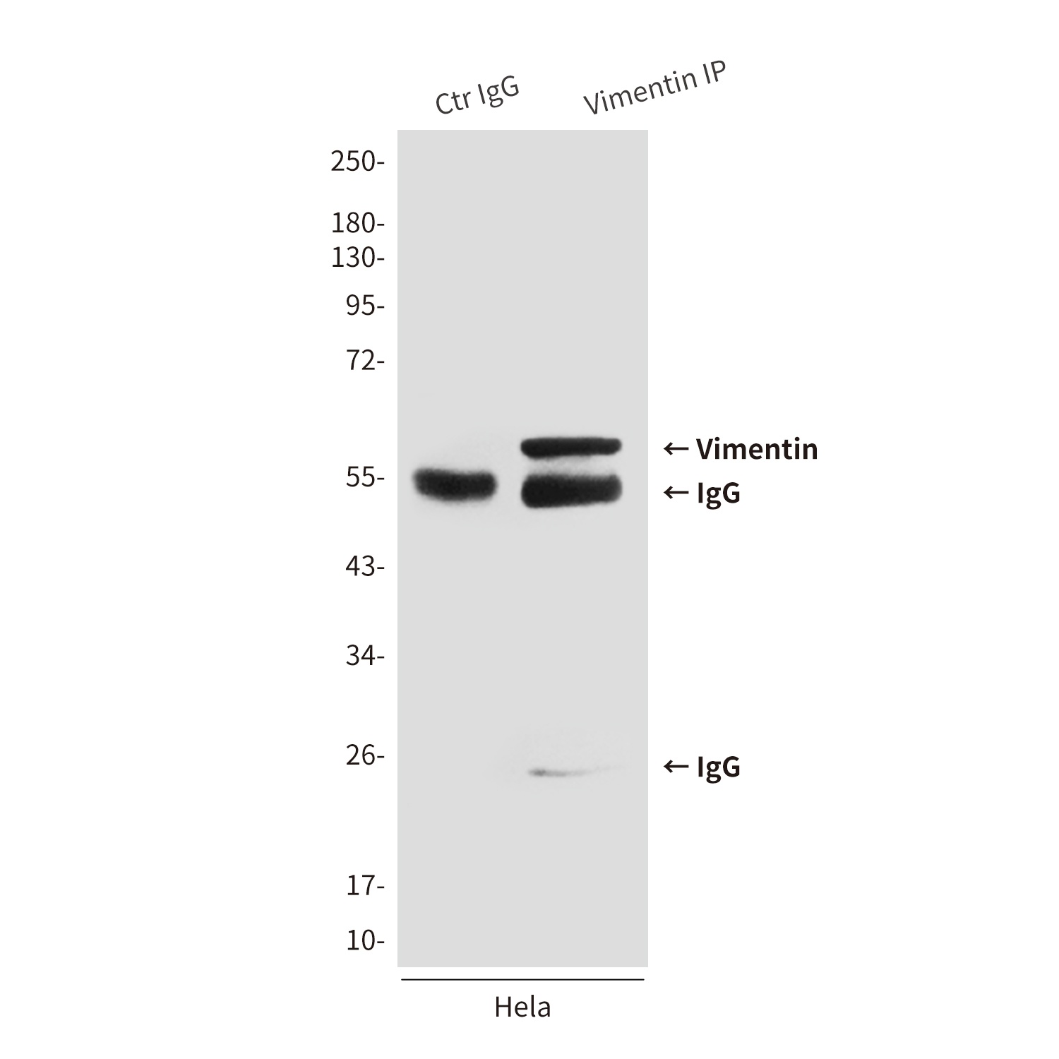 VIM Antibody