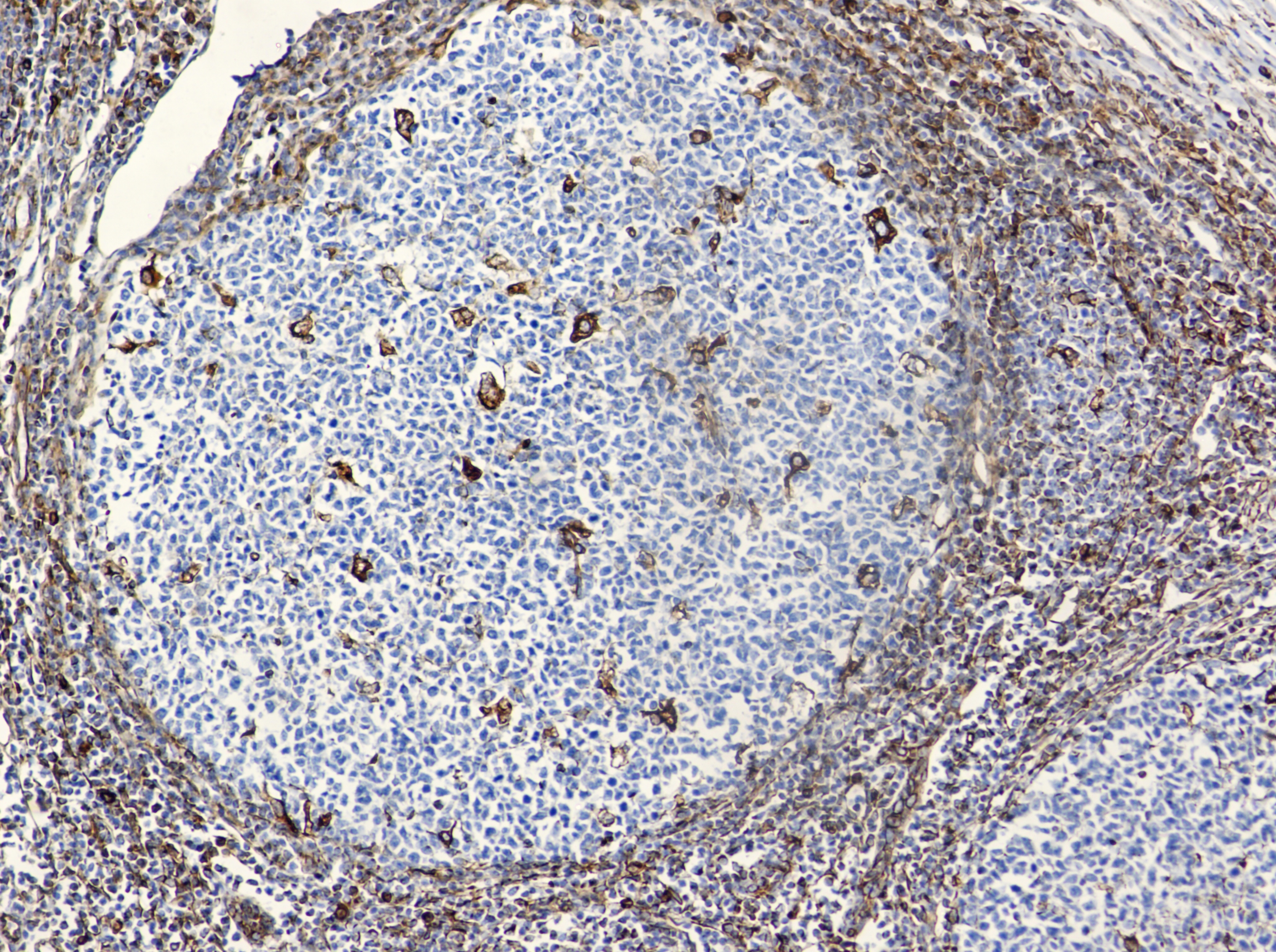 VIM Antibody