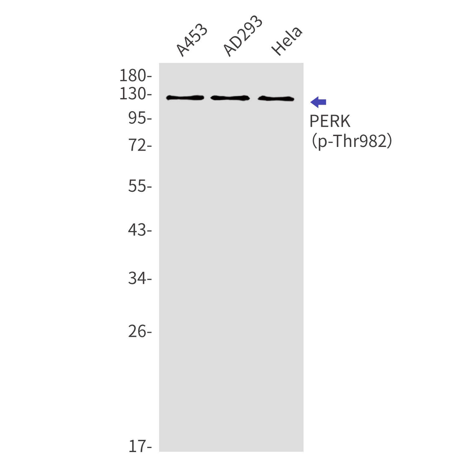 Phospho-PERK (Thr982) Rabbit Polyclonal Antibody