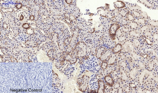 Phospho-PERK (Thr982) Rabbit Polyclonal Antibody