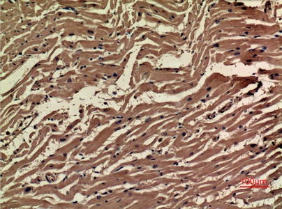 VEGFA Antibody