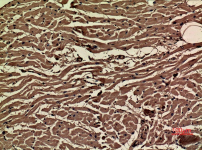 VEGFA Antibody