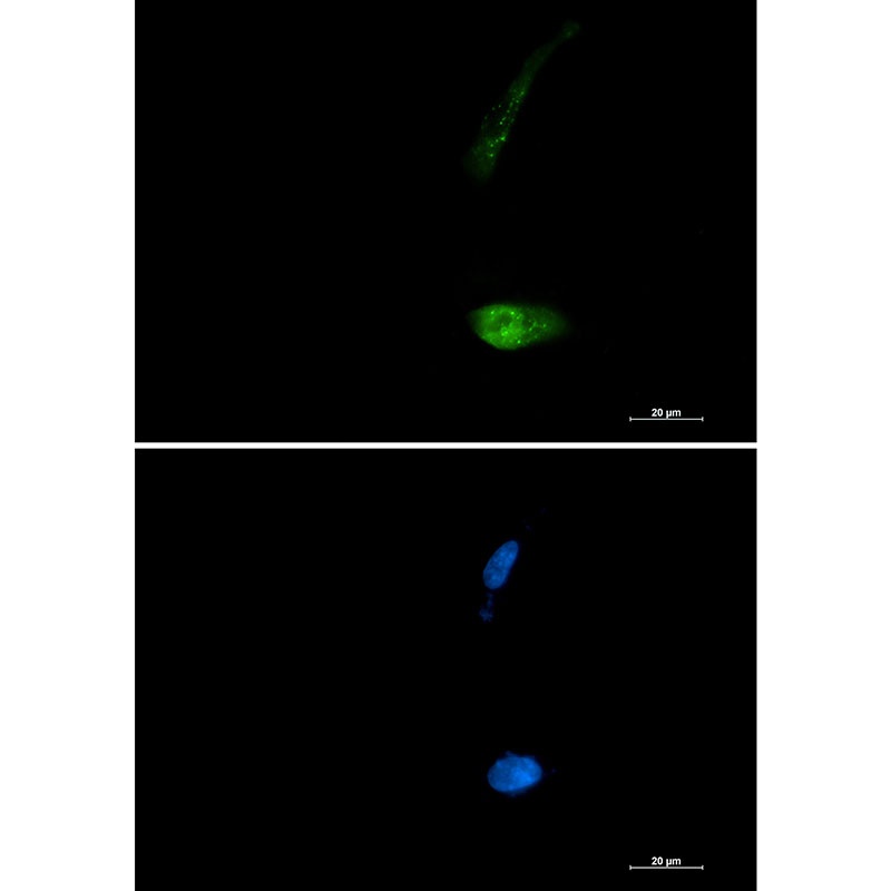 SQSTM1/p62 Rabbit Monoclonal Antibody
