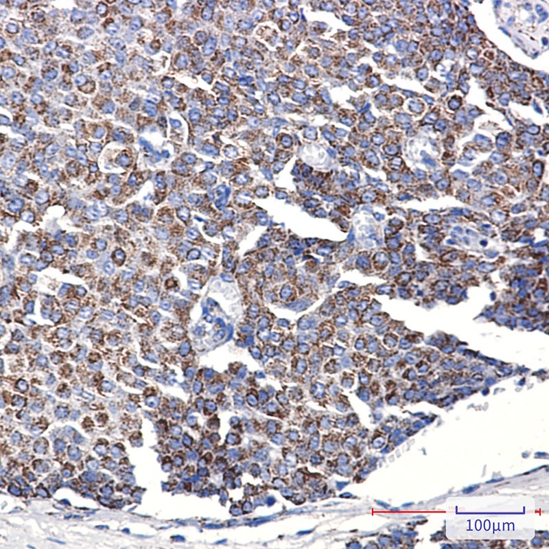 TOMM20 Rabbit Monoclonal Antibody