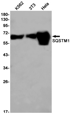 SQSTM1/p62 Rabbit Monoclonal Antibody