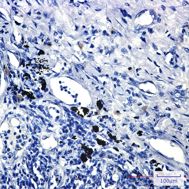 SMAD2 Antibody