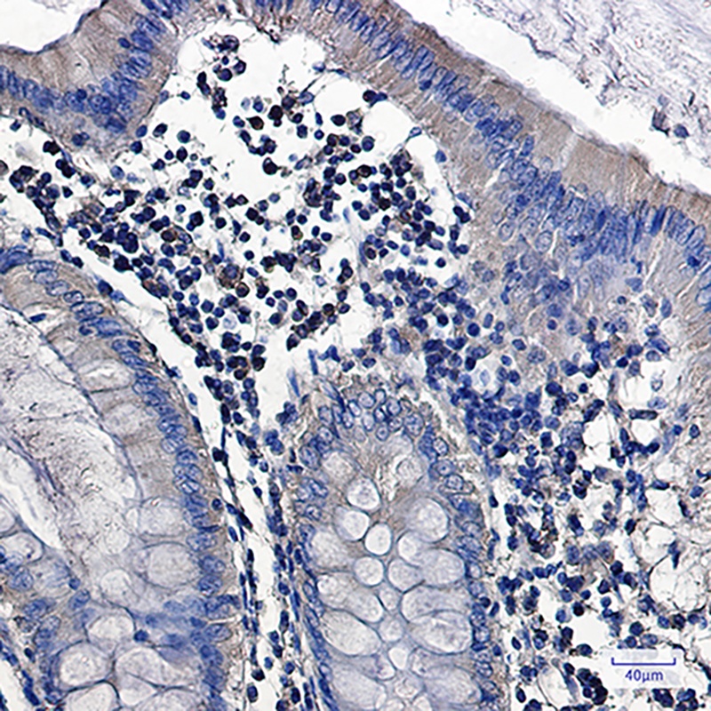 PRKCA Antibody