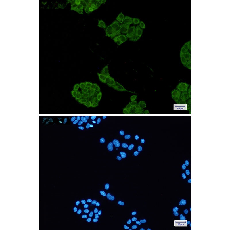 Lactate Dehydrogenase A Rabbit Monoclonal Antibody