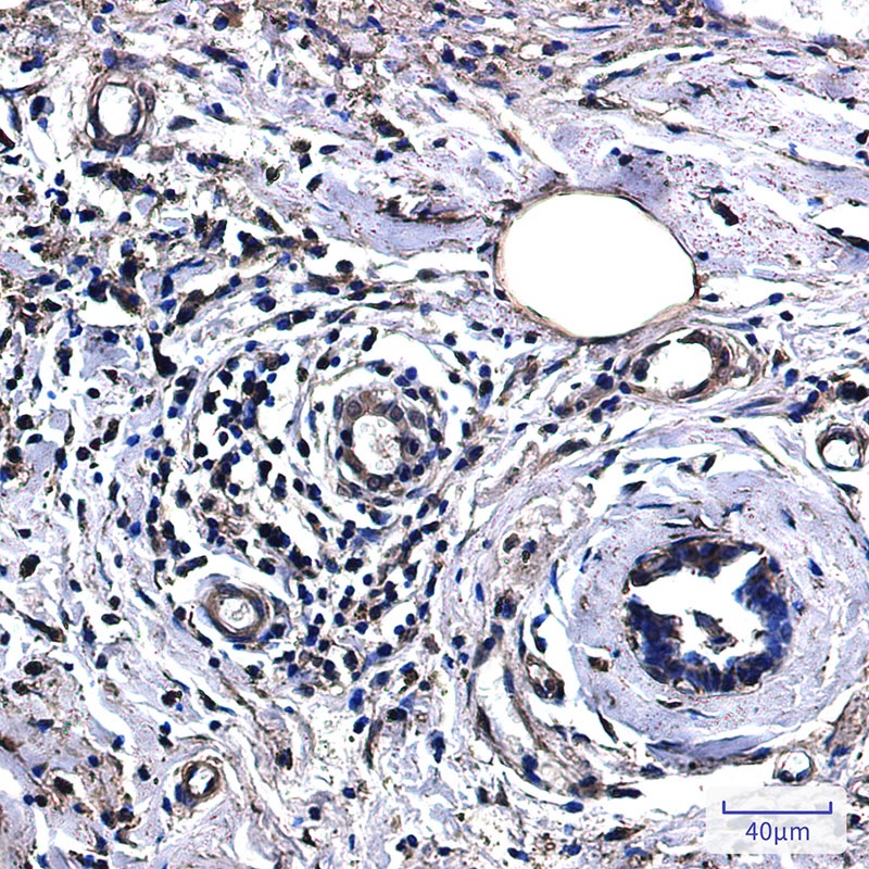 Lactate Dehydrogenase A Rabbit Monoclonal Antibody
