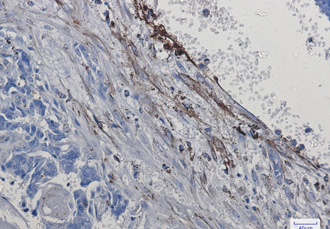 ITGA5 Antibody