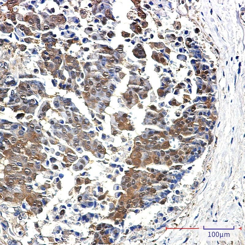 EIF4EBP1 Antibody