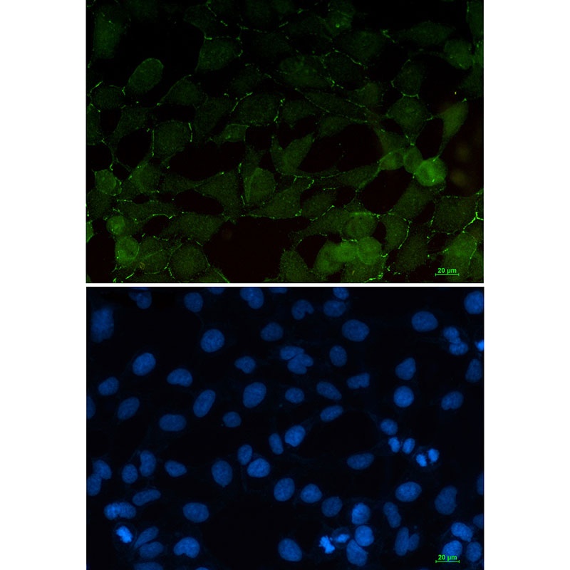 CTNNB1 Antibody