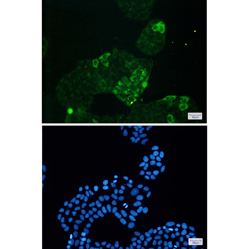Ccnb1 Antibody