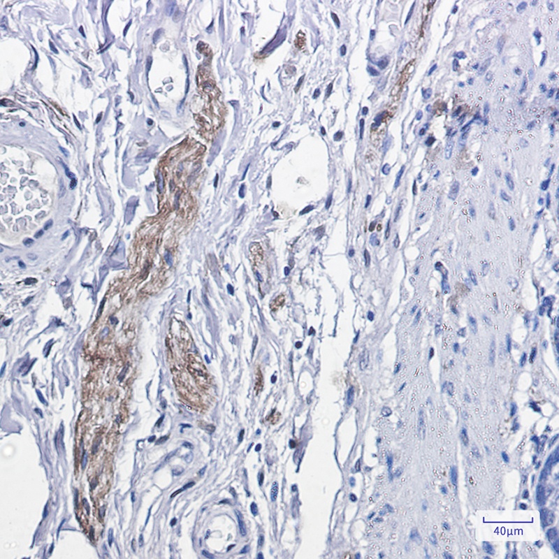 PRKCA Antibody
