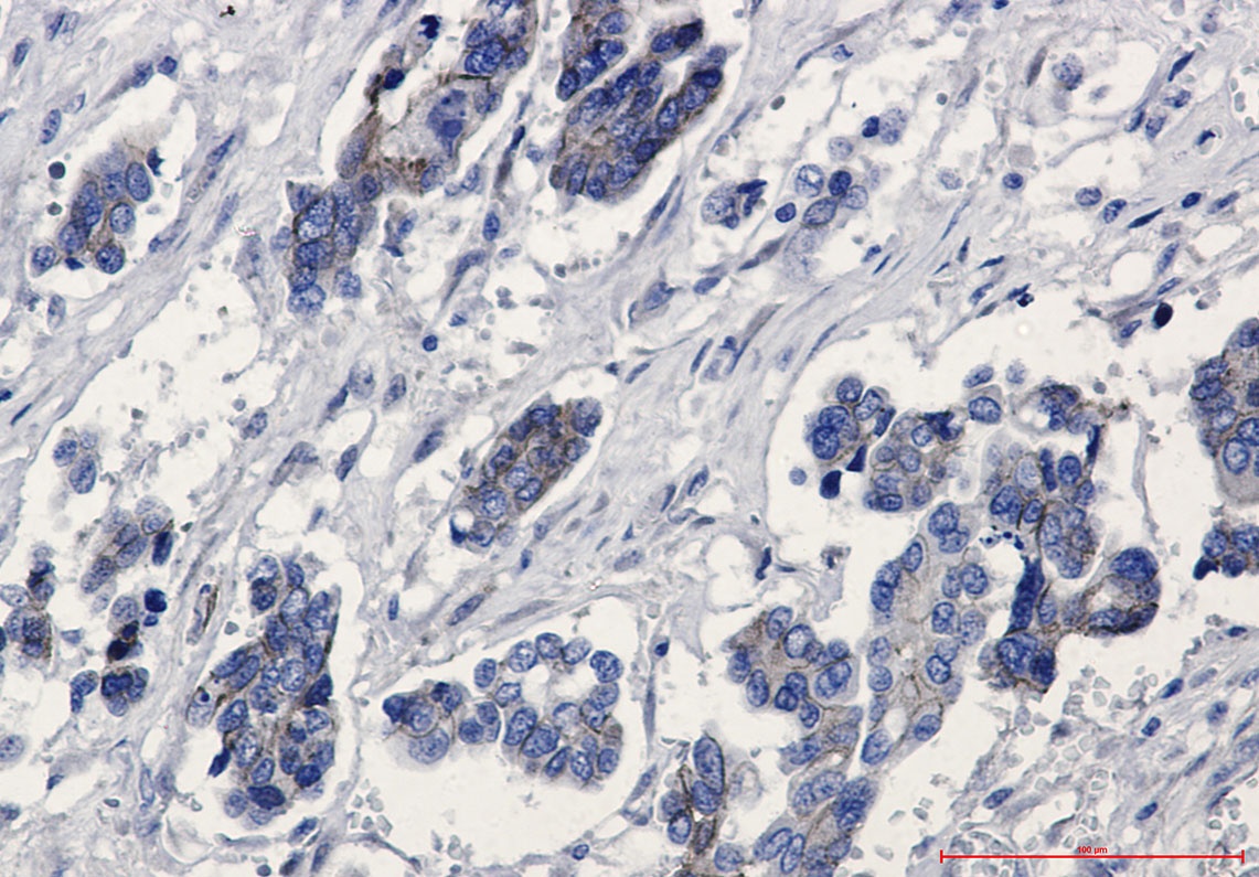 CTNNB1 Antibody