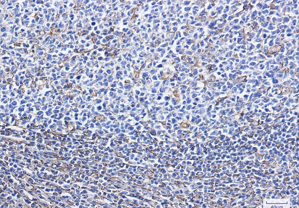 VIM Antibody