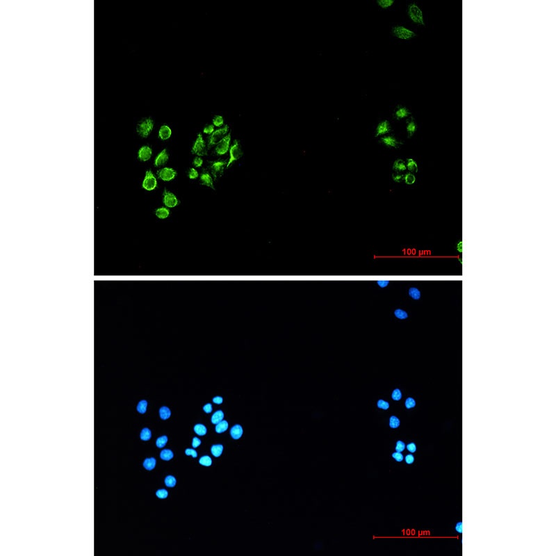VIM Antibody