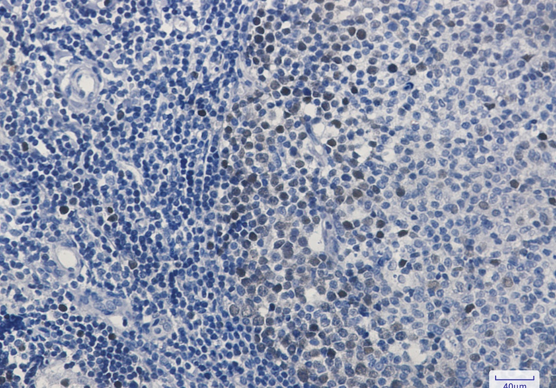 CDK2 Antibody