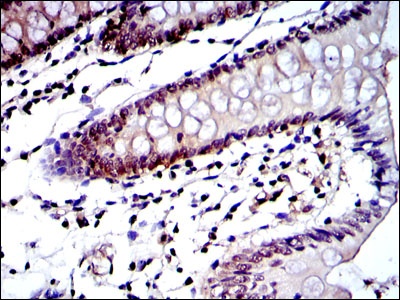 PSMB8 Antibody