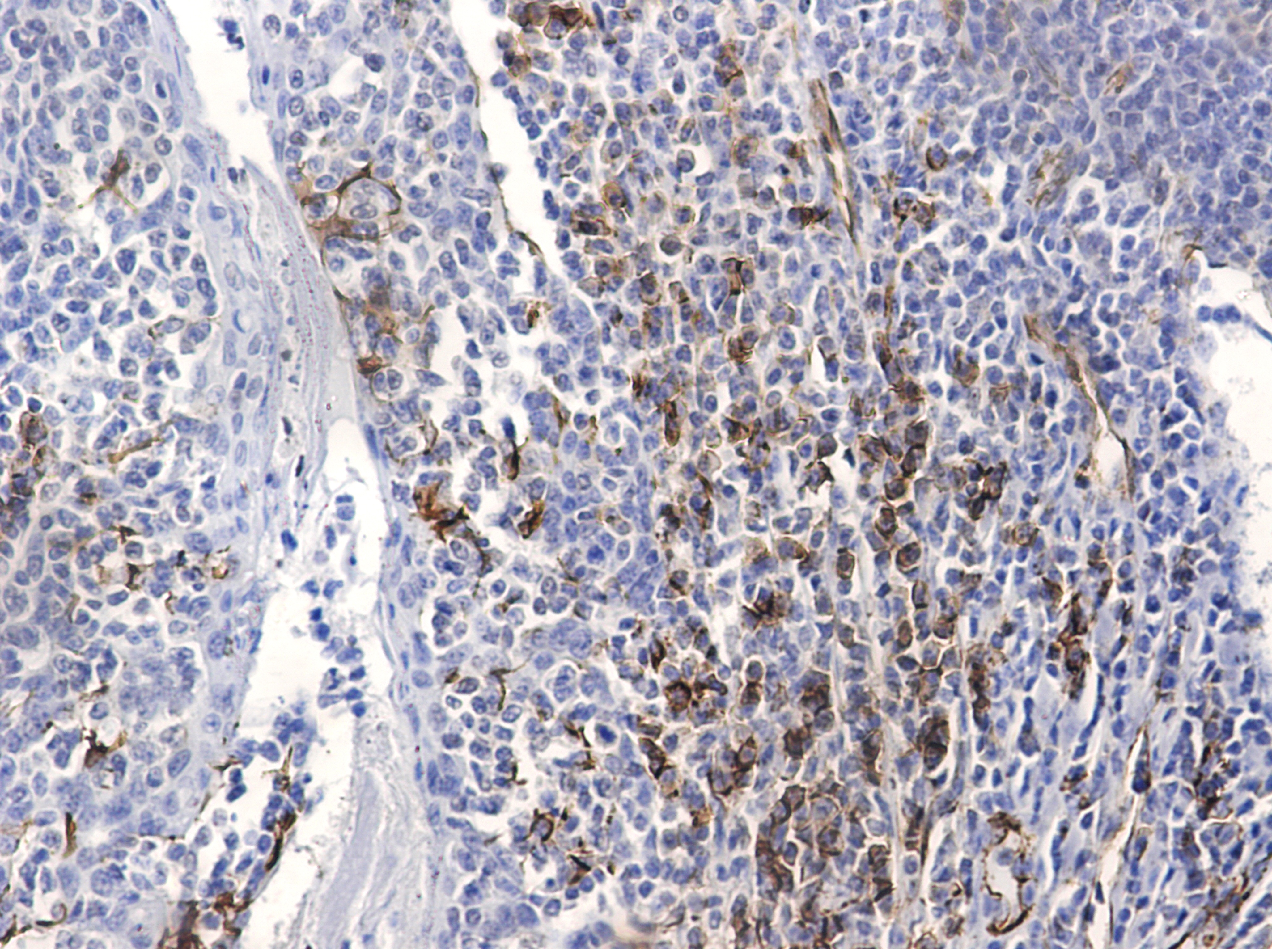 CD31 (5E2) Mouse mAb