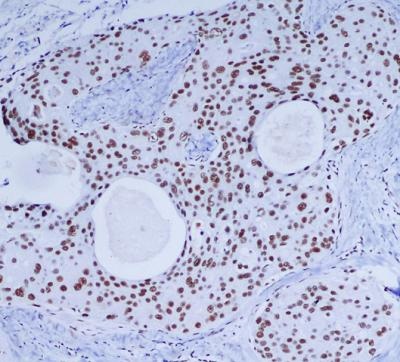 DNA PKcs Mouse Monoclonal Antibody
