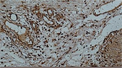 LGALS3 Antibody