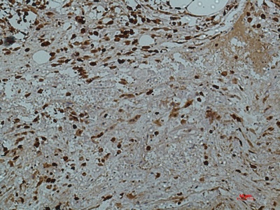 LGALS3 Antibody