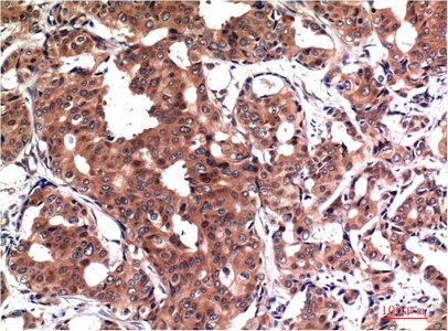GSK3B Antibody