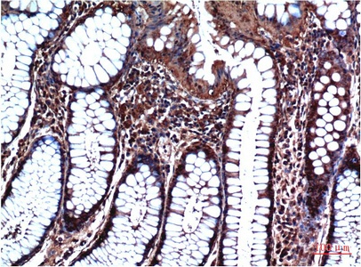 GSK3B Antibody