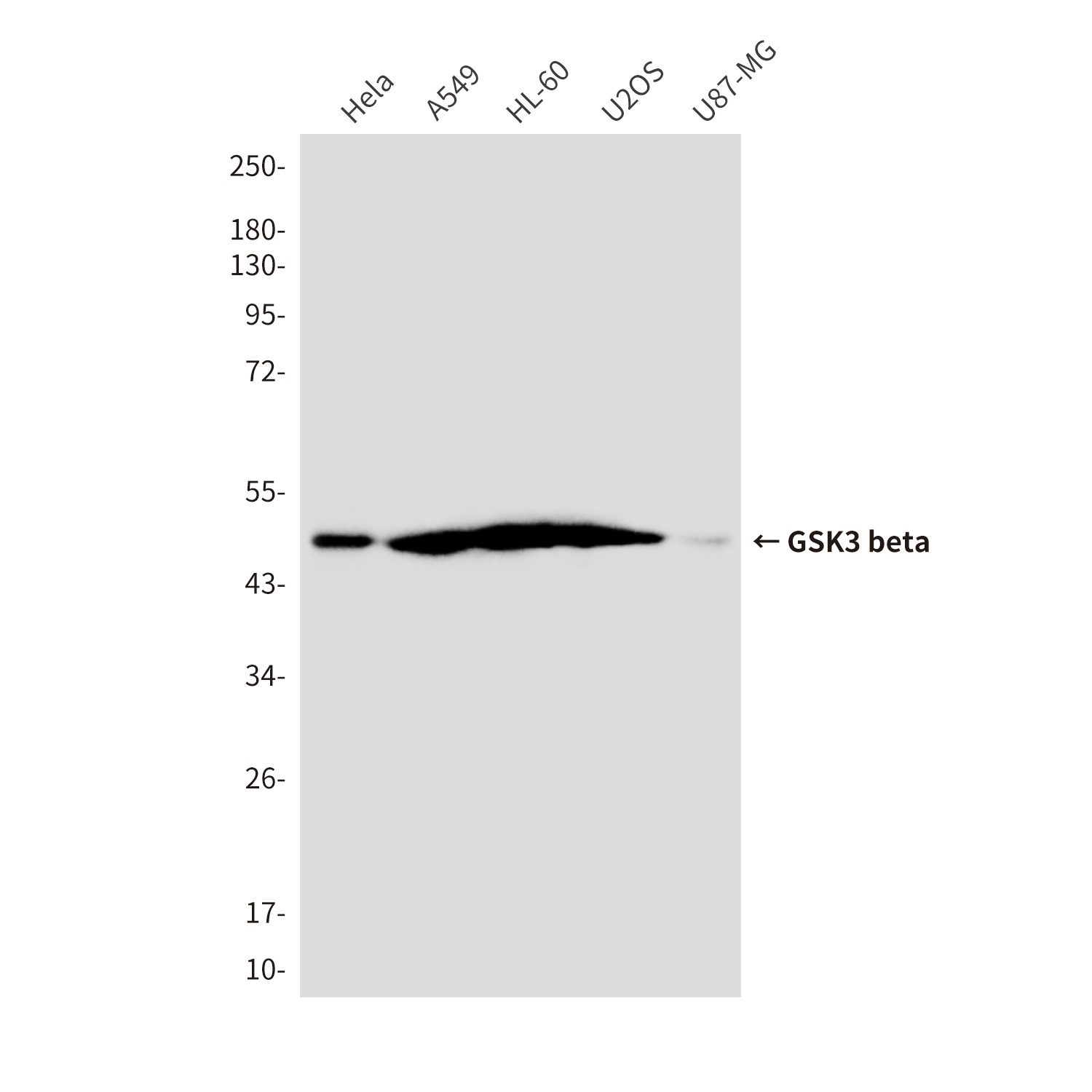 GSK3B Antibody