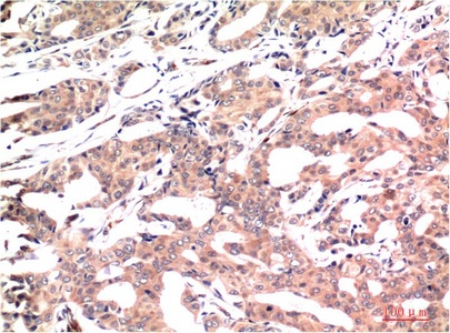 GSK3B Antibody
