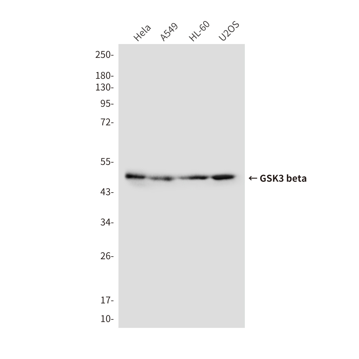 GSK3B Antibody
