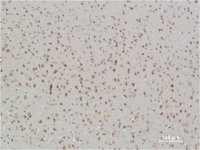 RELA Antibody