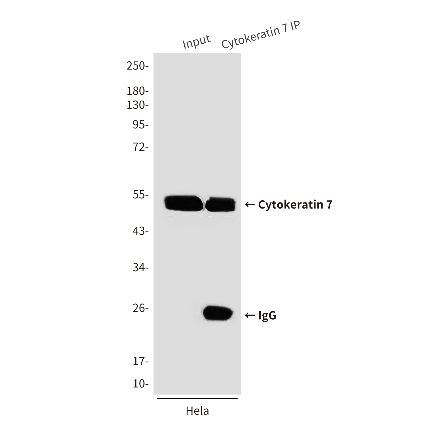 Cytokeratin 7 Mouse Monoclonal Antibody