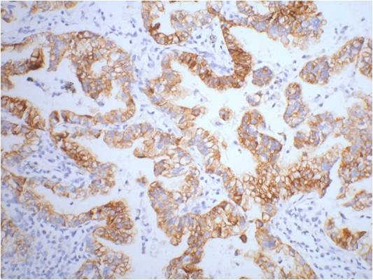 Cytokeratin 7 Mouse Monoclonal Antibody