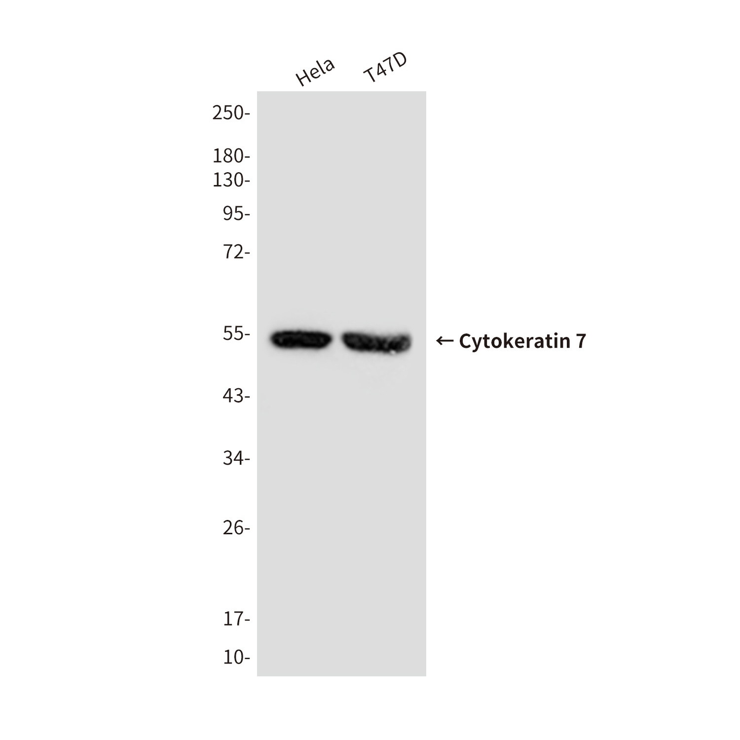 Cytokeratin 7 Mouse Monoclonal Antibody