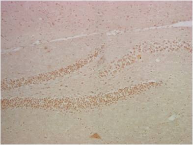 RELA Antibody