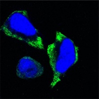 PAK2 Mouse Monoclonal Antibody