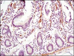 LPP Antibody