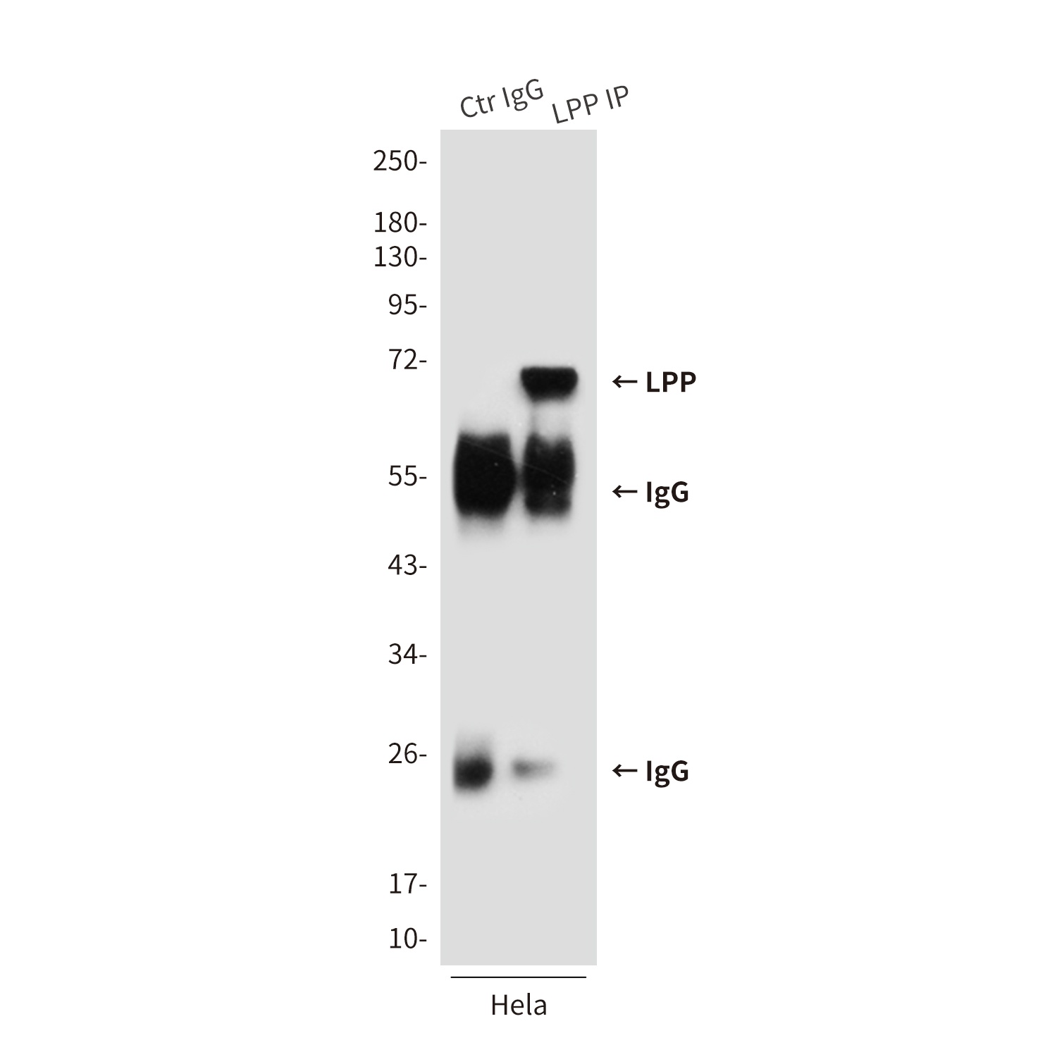 LPP Antibody