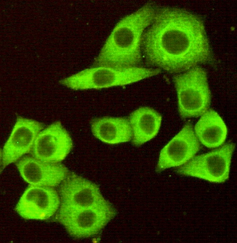 TNFRSF10B (7F4) Mouse mAb