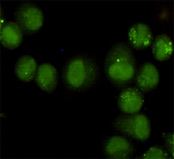 GTF2H1 Mouse Monoclonal Antibody