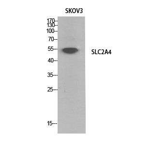 Glucose Transporter GLUT4 Rabbit pAb