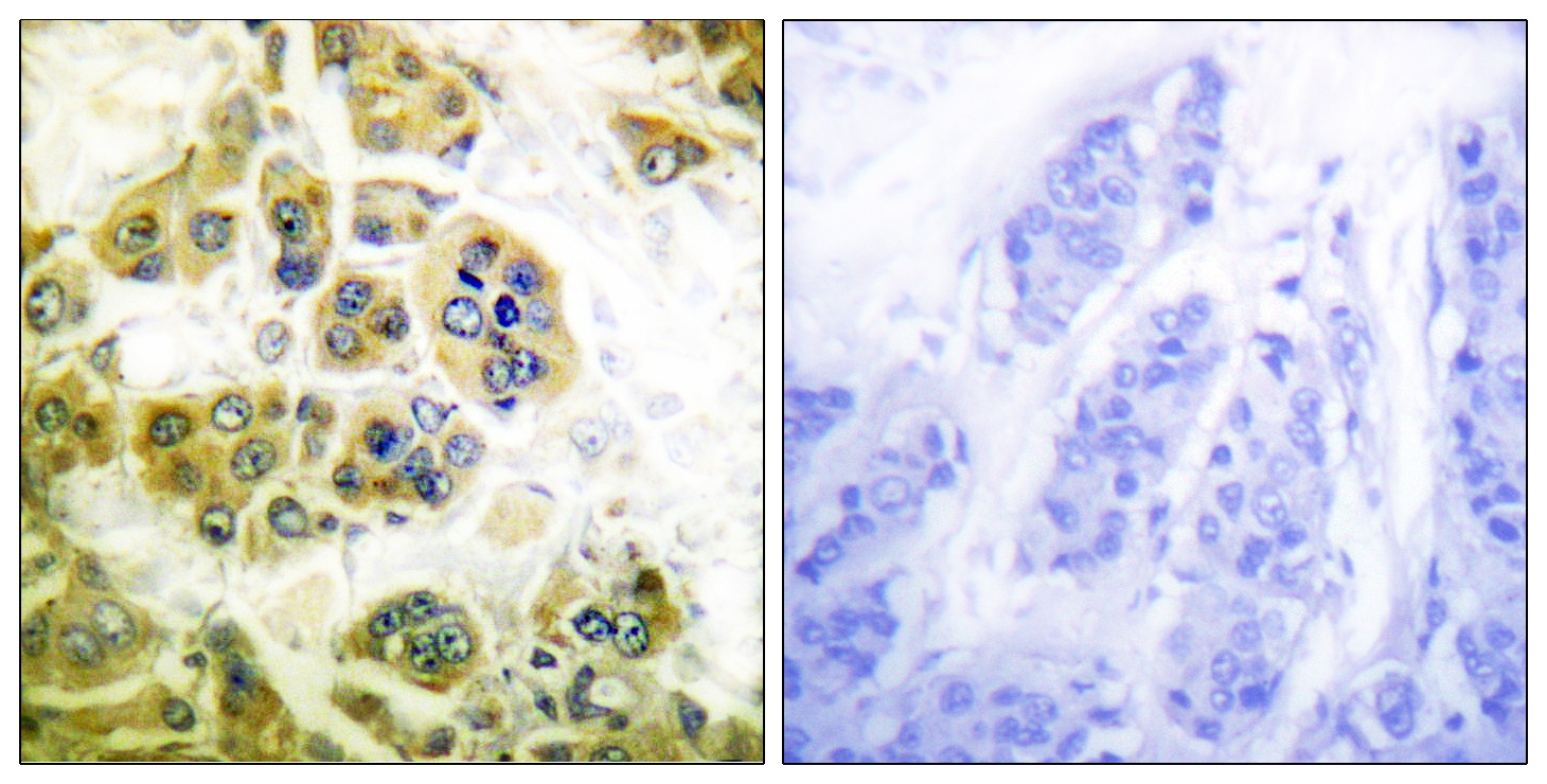CHUK/IKBKB Antibody