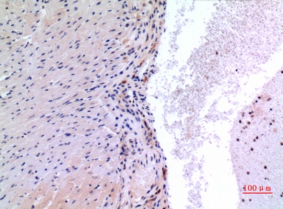 VEGFC Antibody